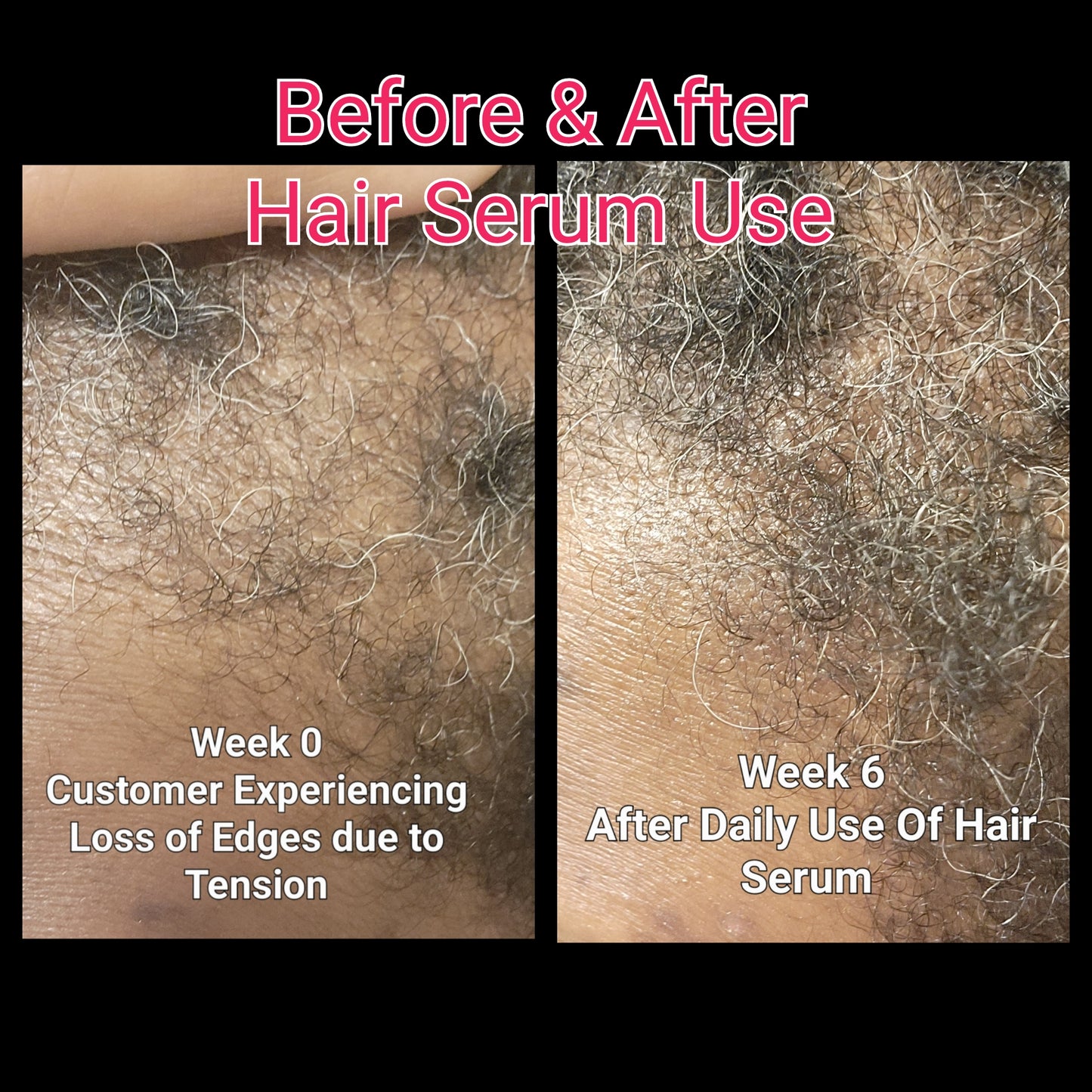 Plant-Based Hair Growth Serum